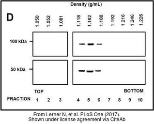 Anti-TSG101 antibody [4A10] used in Western Blot (WB). GTX70255