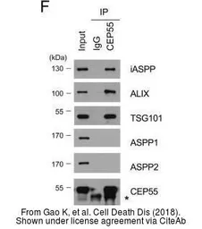 Anti-TSG101 antibody [4A10] used in Western Blot (WB). GTX70255