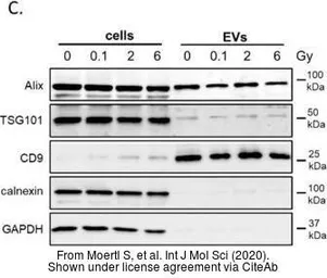 Anti-TSG101 antibody [4A10] used in Western Blot (WB). GTX70255