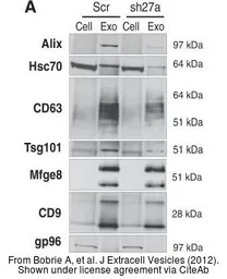 Anti-TSG101 antibody [4A10] used in Western Blot (WB). GTX70255