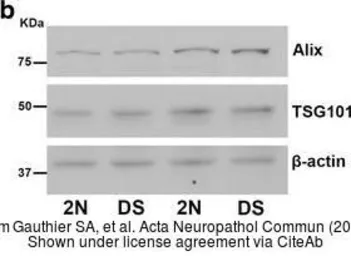 Anti-TSG101 antibody [4A10] used in Western Blot (WB). GTX70255