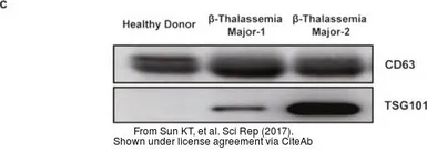Anti-TSG101 antibody [4A10] used in Western Blot (WB). GTX70255