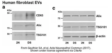 Anti-TSG101 antibody [4A10] used in Western Blot (WB). GTX70255