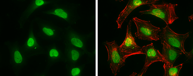 Anti-CtIP antibody [19E8] used in Immunocytochemistry/ Immunofluorescence (ICC/IF). GTX70264