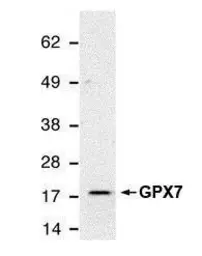 Anti-GPX7 antibody [2704] used in Western Blot (WB). GTX70266