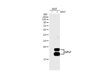 Anti-GPX7 antibody [2704] used in Western Blot (WB). GTX70266