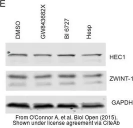 Anti-Hec1 antibody [9G3.23] used in Western Blot (WB). GTX70268
