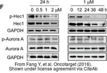Anti-Hec1 antibody [9G3.23] used in Western Blot (WB). GTX70268