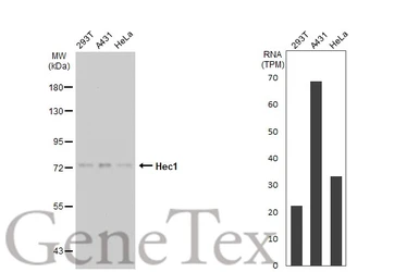 Anti-Hec1 antibody [9G3.23] used in Western Blot (WB). GTX70268