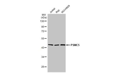 Anti-PSMC5 antibody [25D5] used in Western Blot (WB). GTX70288