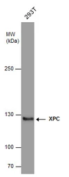 Anti-XPC antibody [3.26] used in Western Blot (WB). GTX70294
