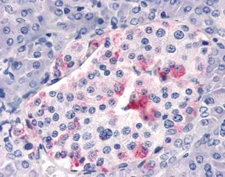 Anti-Respiratory Syncytial virus A2 G protein antibody used in Immunohistochemistry (IHC). GTX70381