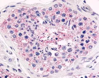 Anti-Antennapedia homeodomain antibody used in Immunohistochemistry (IHC). GTX70384