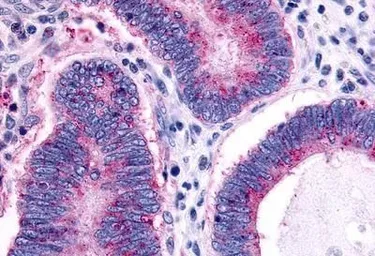 Anti-CCR1 antibody used in IHC (Paraffin sections) (IHC-P). GTX70509