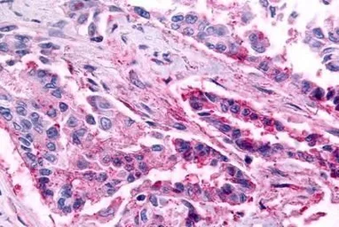 Anti-CCR1 antibody used in IHC (Paraffin sections) (IHC-P). GTX70509