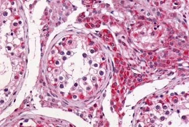 Anti-GPR64 antibody used in IHC (Paraffin sections) (IHC-P). GTX70515