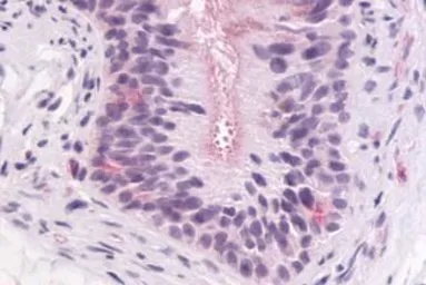 Anti-GPR64 antibody used in IHC (Paraffin sections) (IHC-P). GTX70517