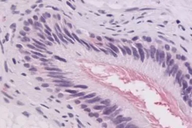 Anti-GPR64 antibody used in IHC (Paraffin sections) (IHC-P). GTX70517
