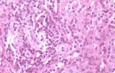 Anti-CXCR3 antibody used in IHC (Paraffin sections) (IHC-P). GTX70527