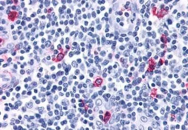 Anti-CXCR3 antibody used in IHC (Paraffin sections) (IHC-P). GTX70527