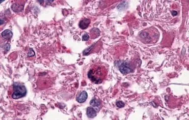 Anti-EDG2 antibody used in IHC (Paraffin sections) (IHC-P). GTX70799