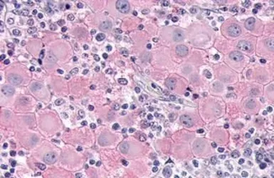 Anti-DUSP26 antibody used in IHC (Paraffin sections) (IHC-P). GTX70939