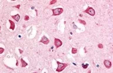 Anti-MAP4K6 antibody used in IHC (Paraffin sections) (IHC-P). GTX70987