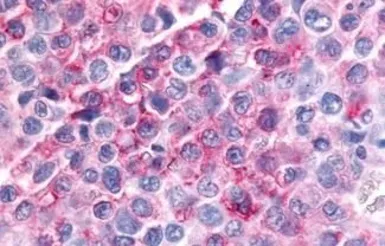 Anti-MAP4K6 antibody used in IHC (Paraffin sections) (IHC-P). GTX70987