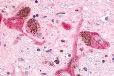 Anti-MAP4K6 antibody used in IHC (Paraffin sections) (IHC-P). GTX70987