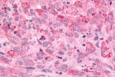 Anti-MAP4K6 antibody used in IHC (Paraffin sections) (IHC-P). GTX70987