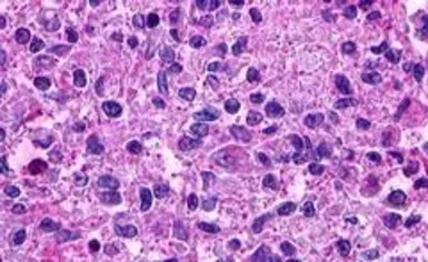Anti-LGR5 antibody used in IHC (Paraffin sections) (IHC-P). GTX71143