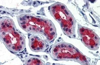 Anti-TSH receptor antibody used in IHC (Paraffin sections) (IHC-P). GTX71175