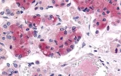 Anti-AVPR1B antibody used in IHC (Paraffin sections) (IHC-P). GTX71413