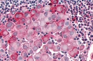 Anti-OR10R2 antibody used in IHC (Paraffin sections) (IHC-P). GTX71527