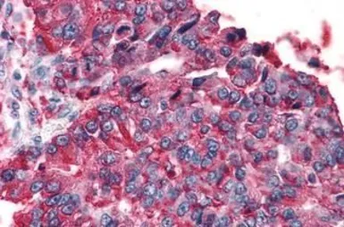 Anti-TAS1R3 antibody used in IHC (Paraffin sections) (IHC-P). GTX71575