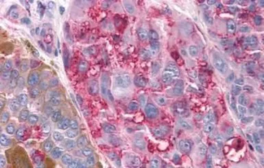 Anti-TAS1R3 antibody used in IHC (Paraffin sections) (IHC-P). GTX71575