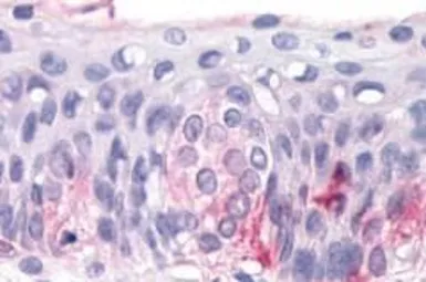Anti-TAS1R3 antibody used in IHC (Paraffin sections) (IHC-P). GTX71575