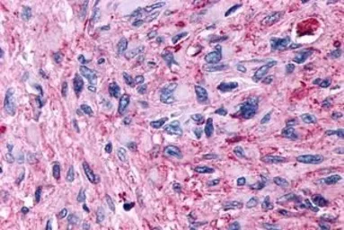 Anti-GPR89A antibody used in IHC (Paraffin sections) (IHC-P). GTX71777