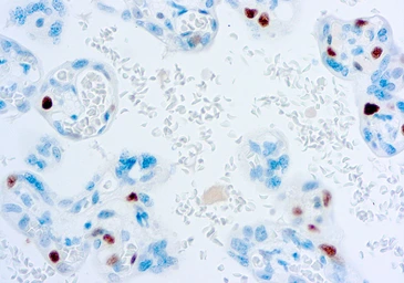Anti-p57 Kip2 antibody [57P06] used in IHC (Paraffin sections) (IHC-P). GTX73917