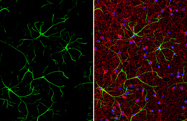 Anti-IL1 beta antibody used in Immunocytochemistry/ Immunofluorescence (ICC/IF). GTX74034