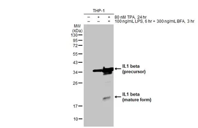Anti-IL1 beta antibody used in Western Blot (WB). GTX74034