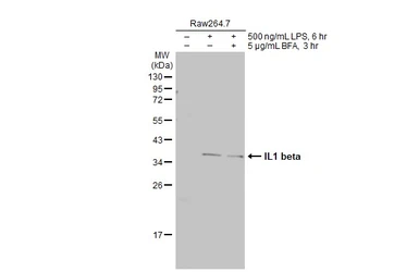 Anti-IL1 beta antibody used in Western Blot (WB). GTX74034