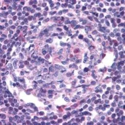 Anti-CCR5 antibody used in IHC (Paraffin sections) (IHC-P). GTX74371
