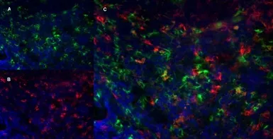 Anti-CD8 alpha antibody [YTS105.18] used in IHC (Frozen sections) (IHC-Fr). GTX74642