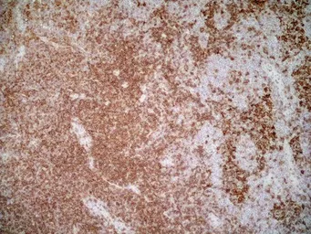 Anti-CD4 antibody [OX-35] (Azide free) used in IHC (Frozen sections) (IHC-Fr). GTX75110