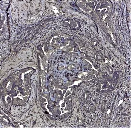 Anti-CD44v6 antibody [VFF-7] used in IHC (Paraffin sections) (IHC-P). GTX75291