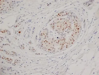 Anti-Progesterone Receptor antibody [1A6] used in IHC (Paraffin sections) (IHC-P). GTX75363
