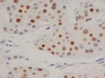 Anti-Progesterone Receptor antibody [1A6] used in IHC (Paraffin sections) (IHC-P). GTX75363