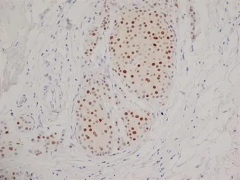 Anti-Progesterone Receptor antibody [1A6] used in IHC (Paraffin sections) (IHC-P). GTX75363