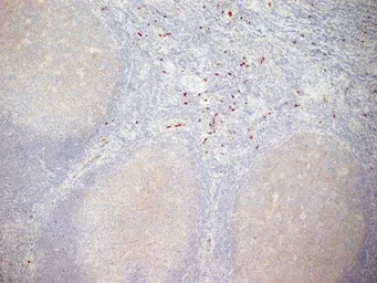 Anti-CD11b antibody [ICRF44] (Azide free) used in IHC (Frozen sections) (IHC-Fr). GTX76296